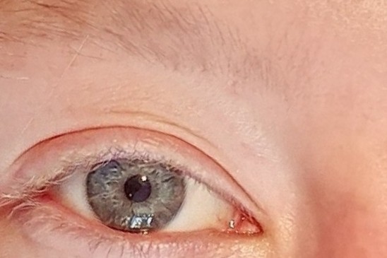 Voor: oog van een klant zonder en met wimperextensions