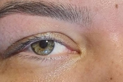 Na: oog en wenkbrauw van een klant, close-up